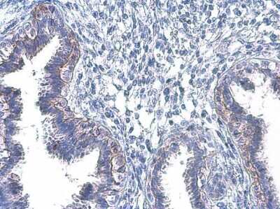 Immunohistochemistry-Paraffin: EGFR [p Tyr1045] Antibody [NBP3-13266]